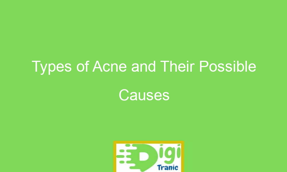 types of acne and their possible causes 20918 - Types of Acne and Their Possible Causes
